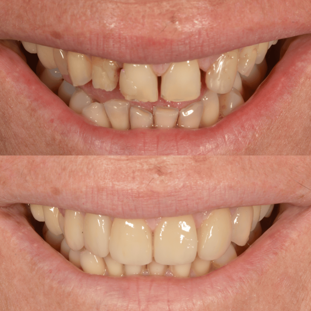 Progetto senza titolo2