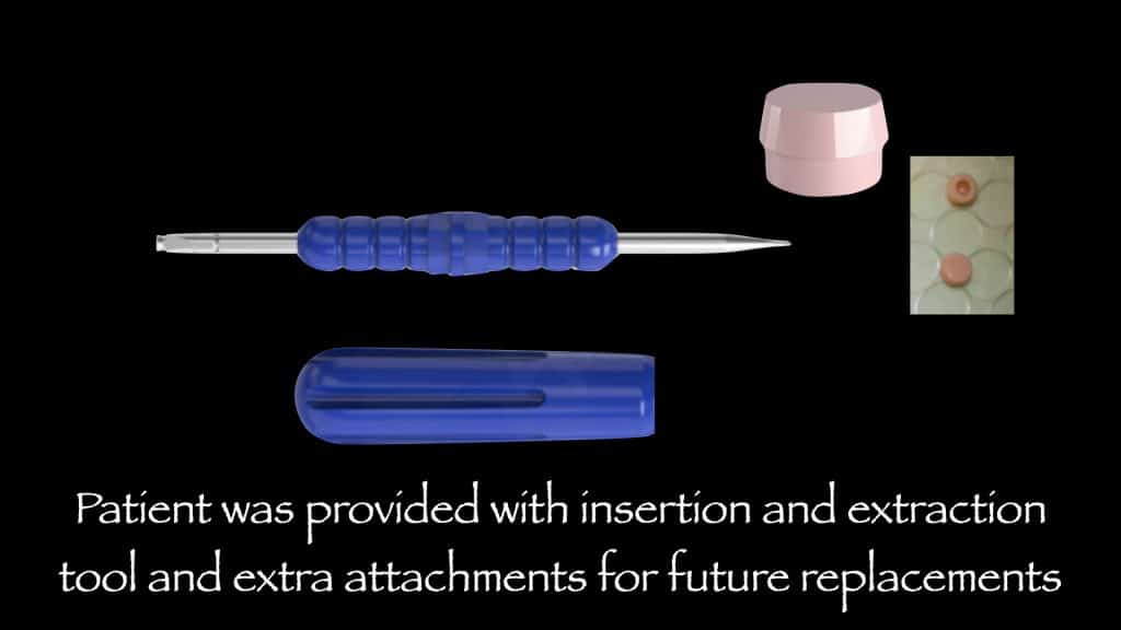 3918329C-33D1-4C1B-9C06-1A79E7FDE31B