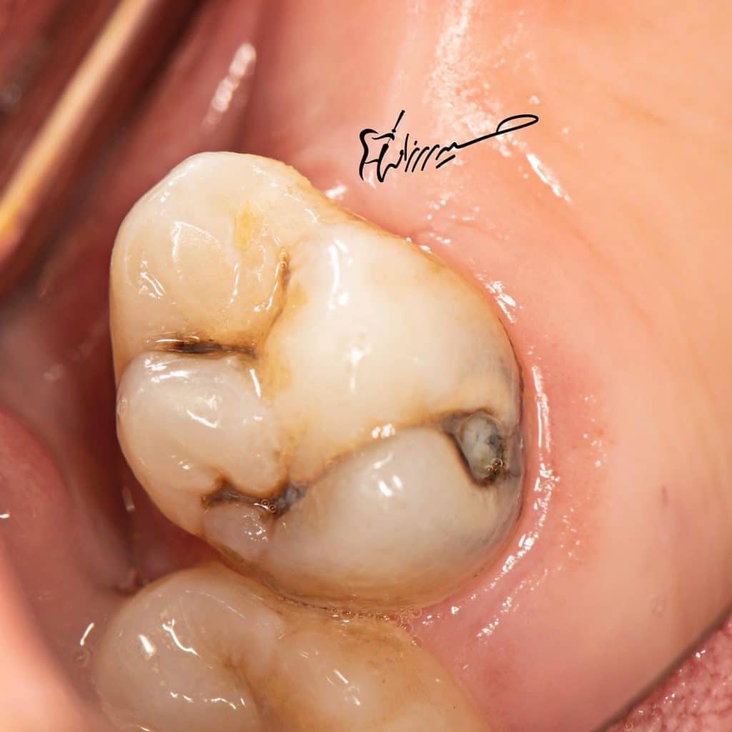 EFA95871-31E8-4003-BA89-3B37A3A89F4F