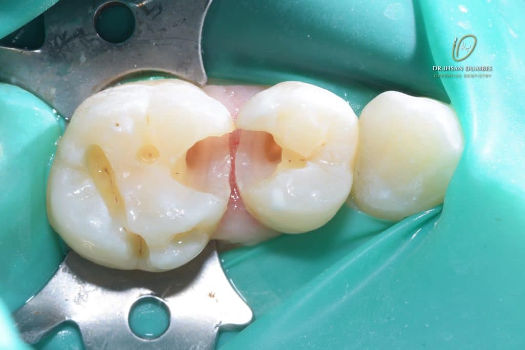 Picsart_22-11-03_20-35-25-850