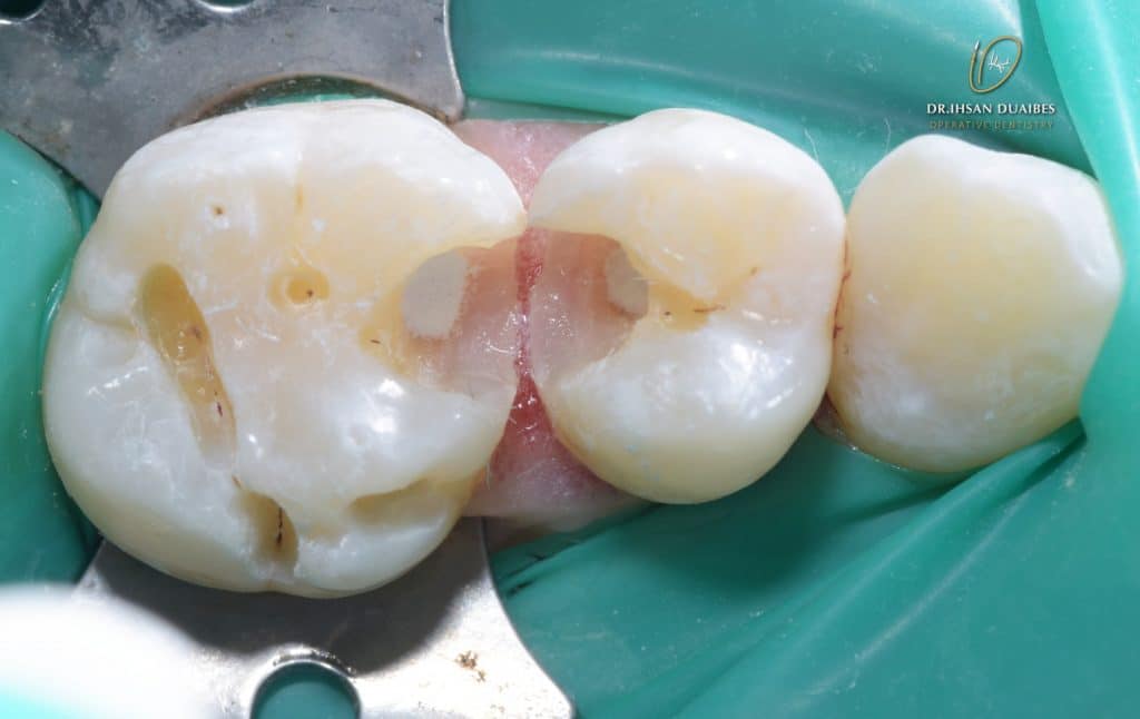 Picsart_22-11-03_20-46-51-979