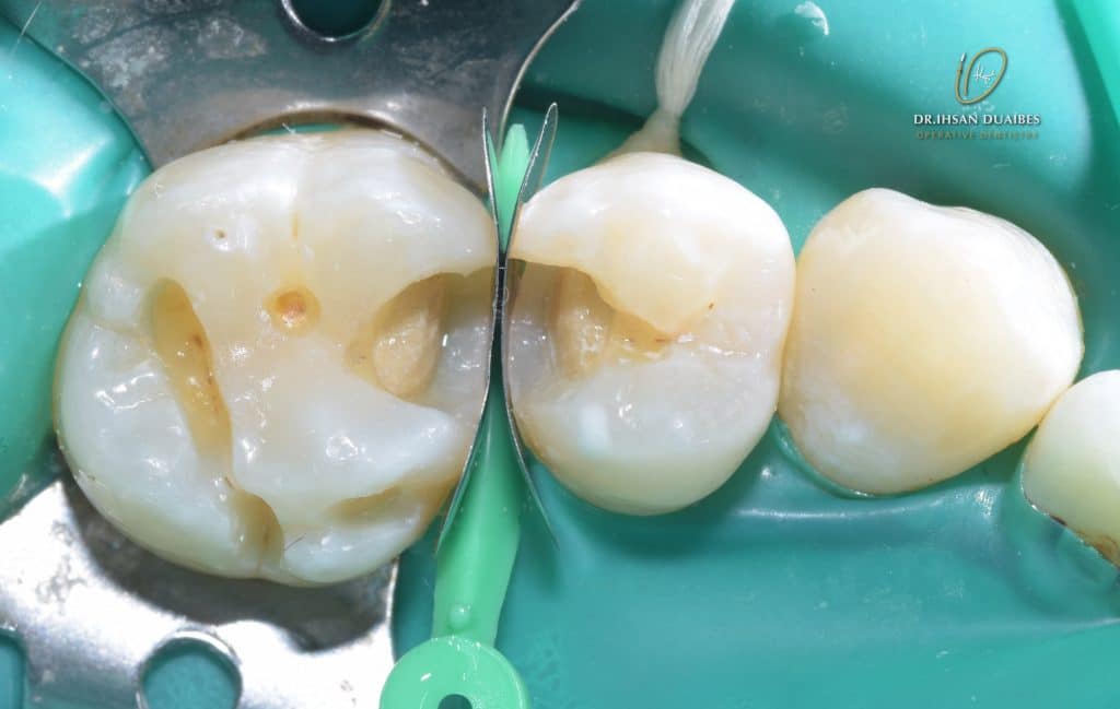 Picsart_22-11-03_21-45-29-513