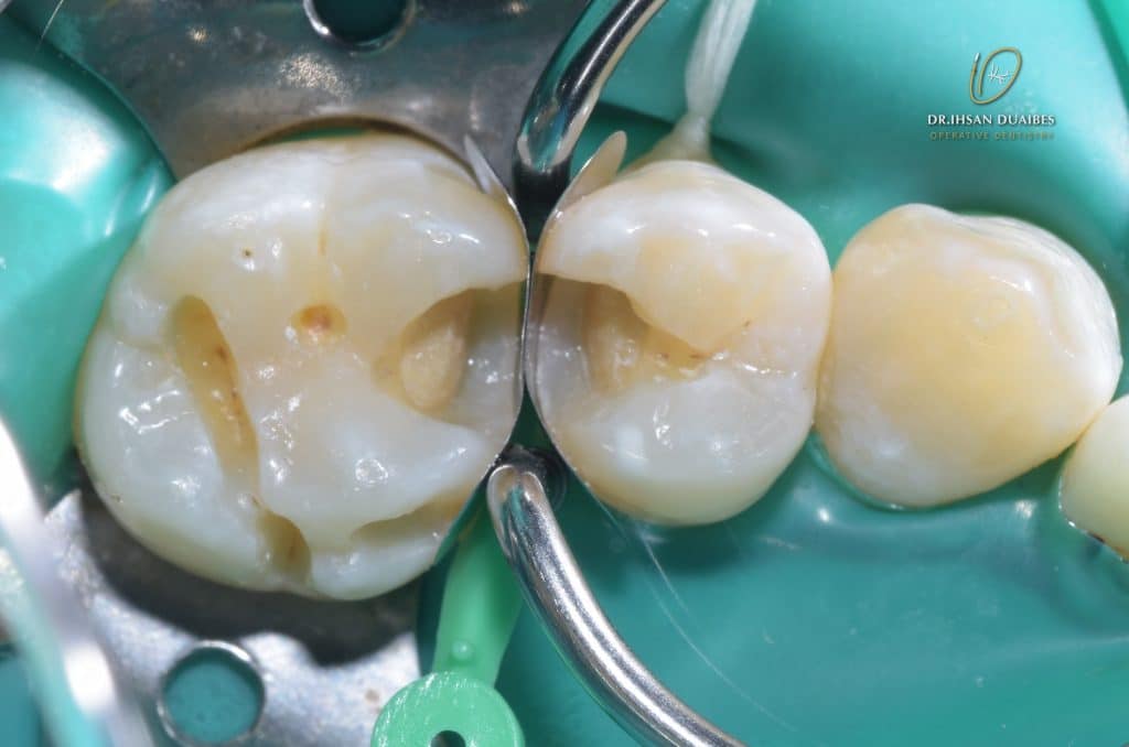 Picsart_22-11-03_21-48-22-849