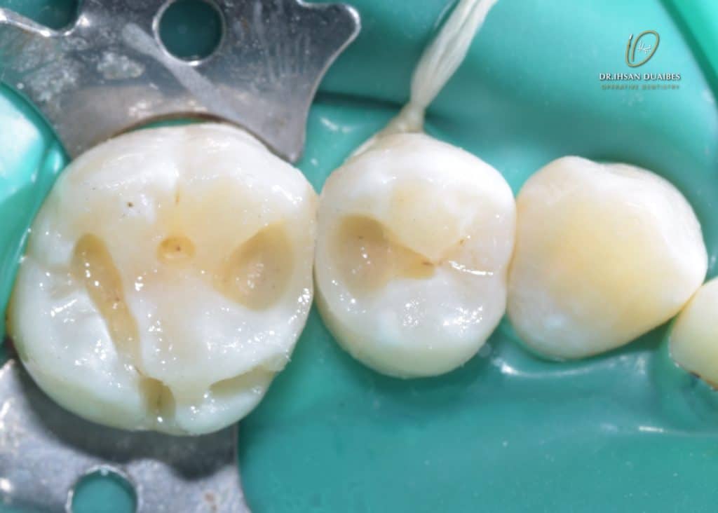 Picsart_22-11-03_22-46-04-011