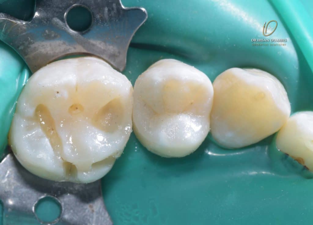 Picsart_22-11-03_22-48-24-033