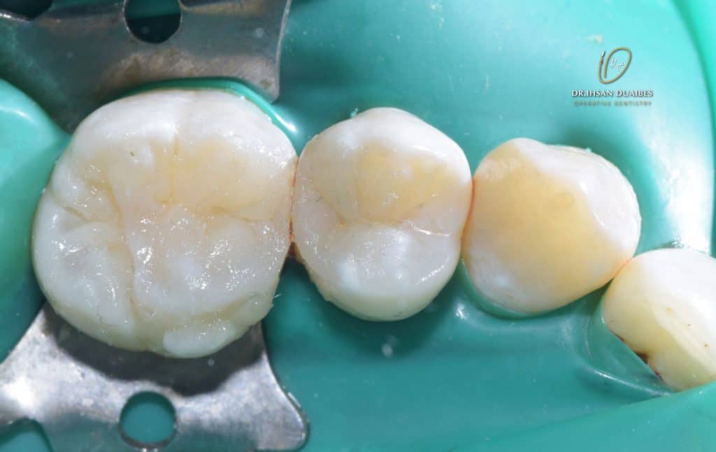 Picsart_22-11-03_22-50-50-914