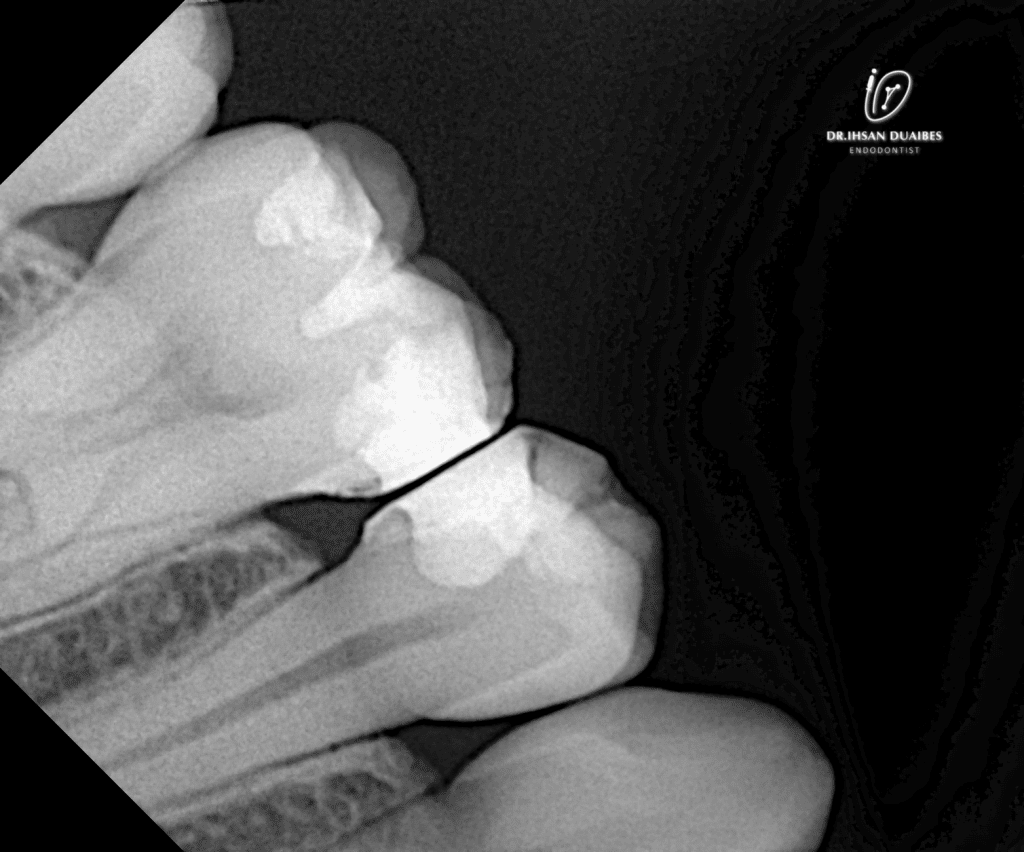 Picsart_22-11-03_22-56-52-558