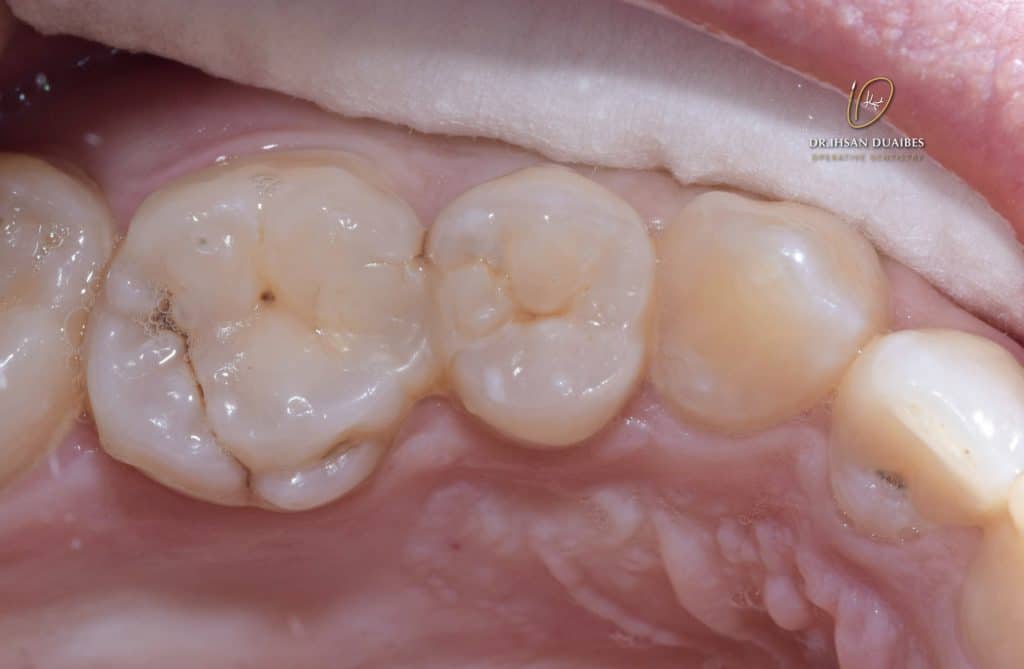 Picsart_22-11-03_23-08-02-549