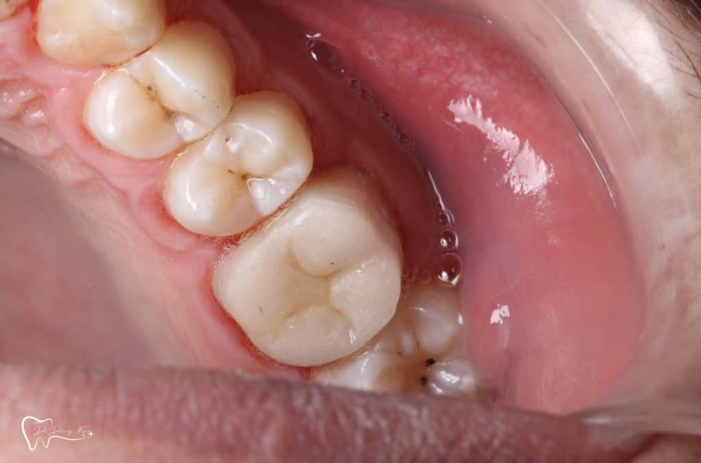 4BA026CB-7A34-4864-9F24-5B052C0CFDAD