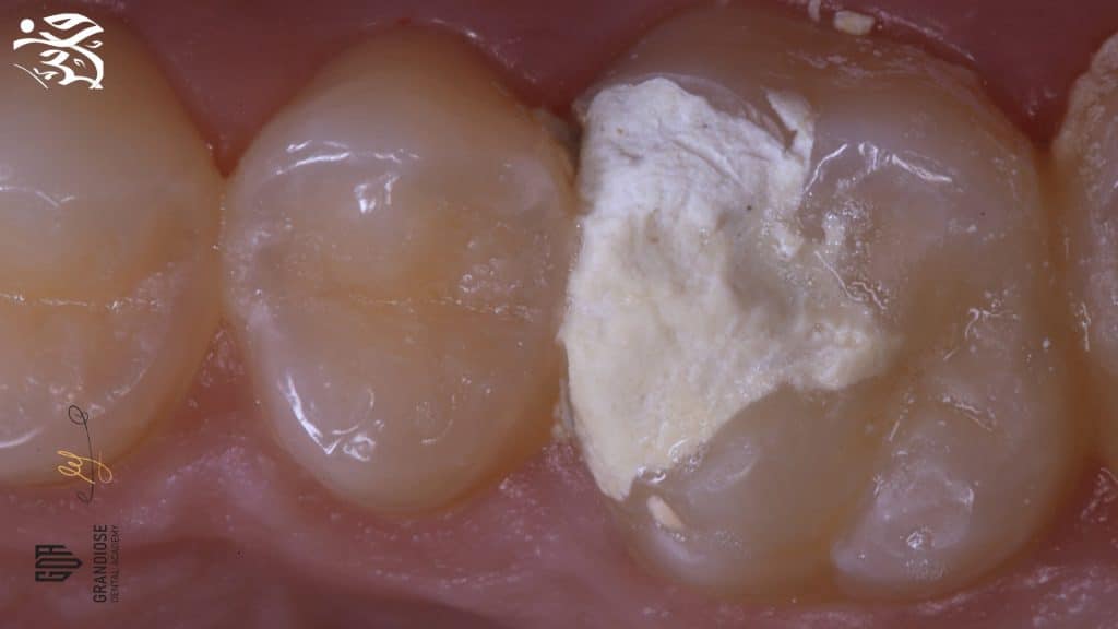 77A41C1C-DCE4-4E8C-8092-9E85AD5A417A