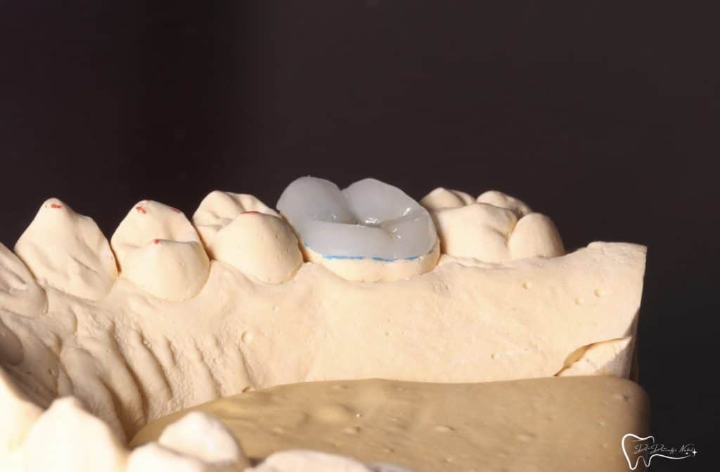 86D15B02-AA77-45F7-9DE7-8C1EA6205C0E