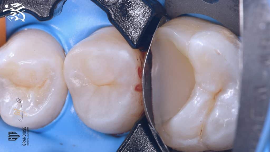 B8701B32-7741-4BF3-B647-162E9B535860