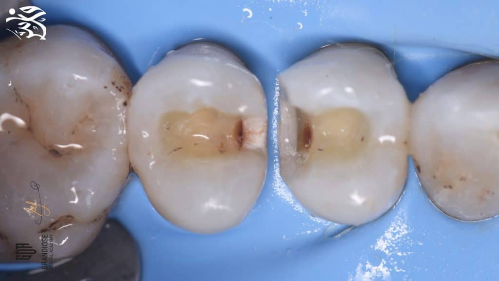 CA2C4719-462A-4F55-9911-952441DA6182