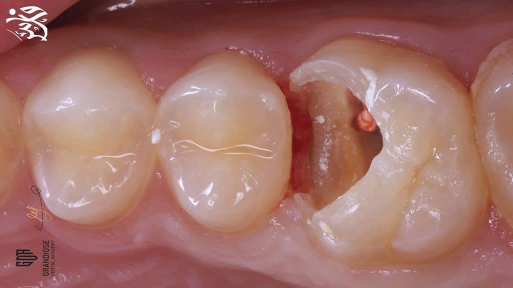 E0411C89-2DC3-43A0-B0D3-12F409BD1174