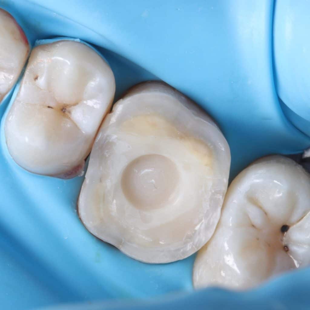 F5F49F1A-131D-48F6-981A-CD68C95C2C99