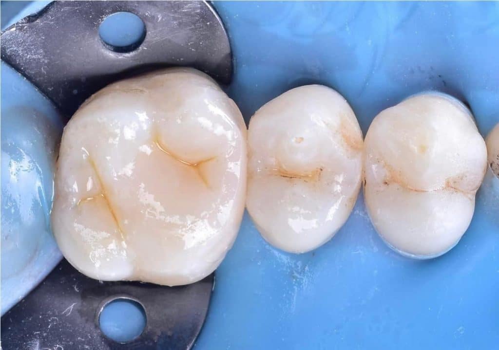 1CB5F549-432C-483A-832F-A902A3BF3DAC