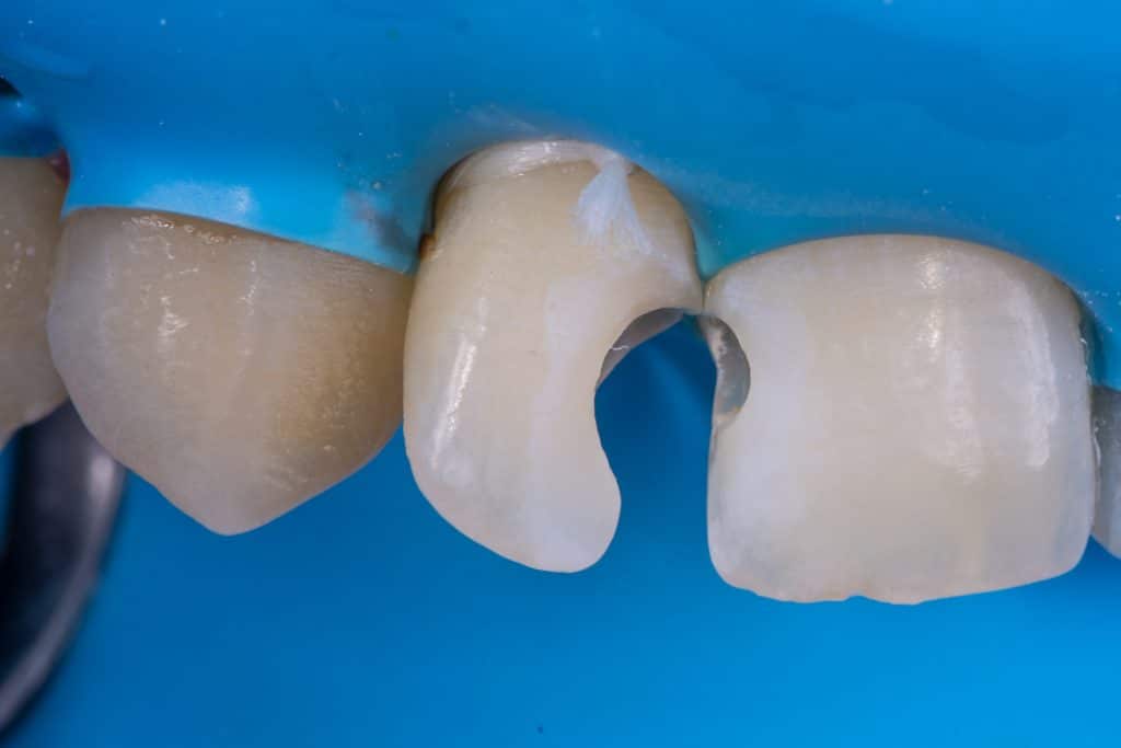 Cleaning & Designing .