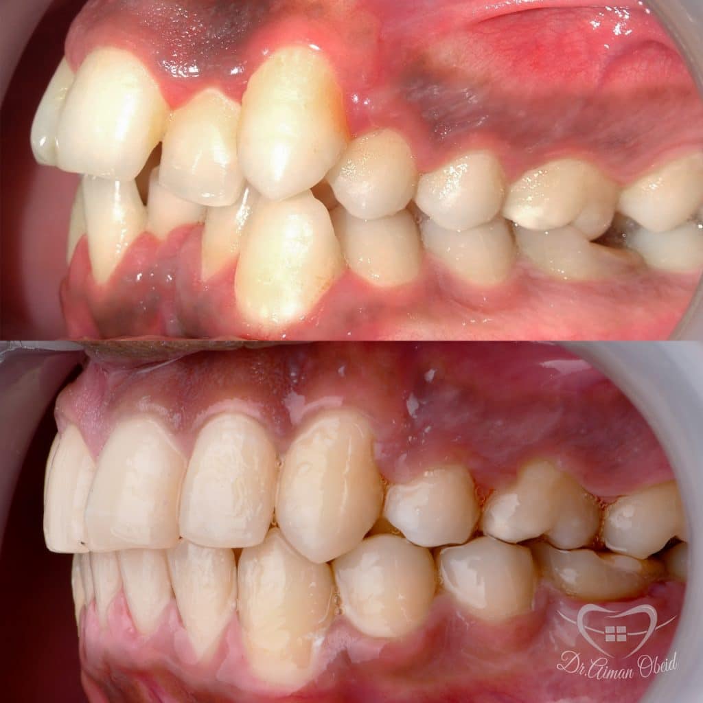 23BB2DC9-F2A4-47FB-B3AD-0A7E49D511E2