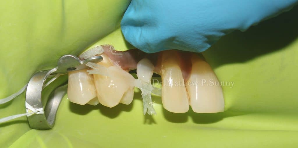 27037-wm-67234.89999999851_watermarked