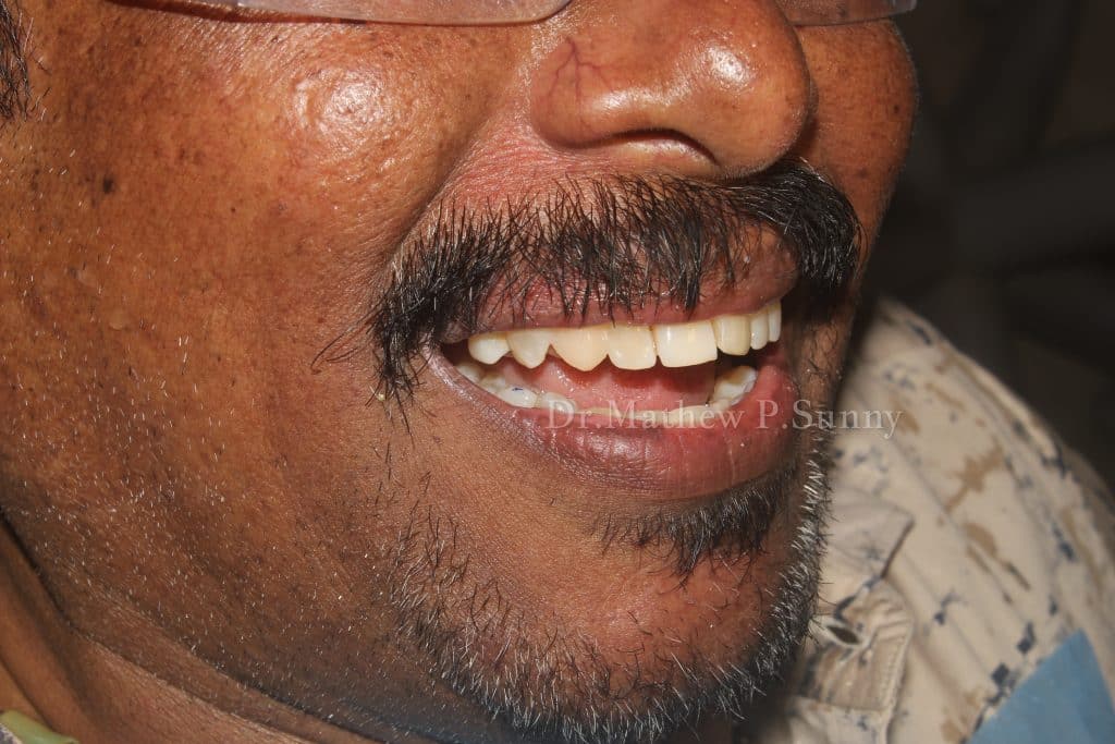 27039-wm-64195.60000000149_watermarked