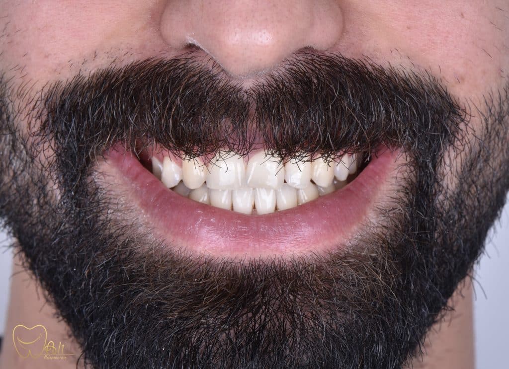 590D58BA-62D6-4407-9093-18F365345E14