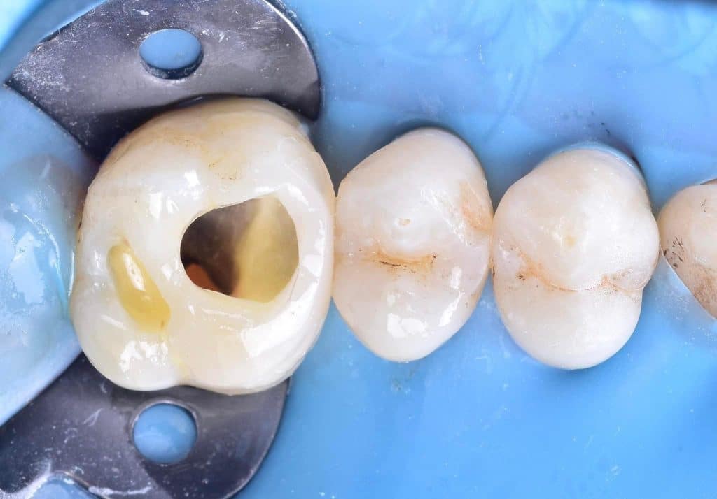 63B3FB87-D924-43FF-9728-EDA7D9F26178