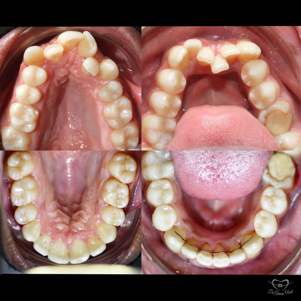 6CE3B824-AE01-4EB1-BDB5-6FBCF512790F