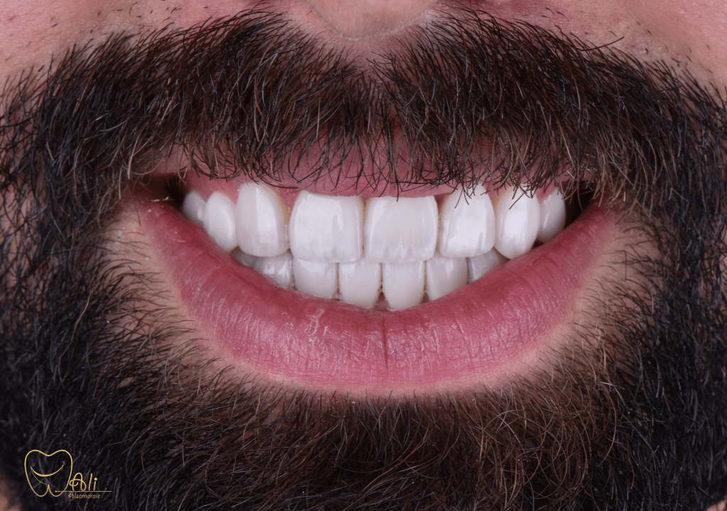 8374FFF1-D12B-42B2-85C2-233F4CCDEDD9