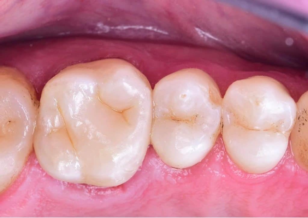 851B5D98-79FE-49EF-B338-CD0442C81AAC