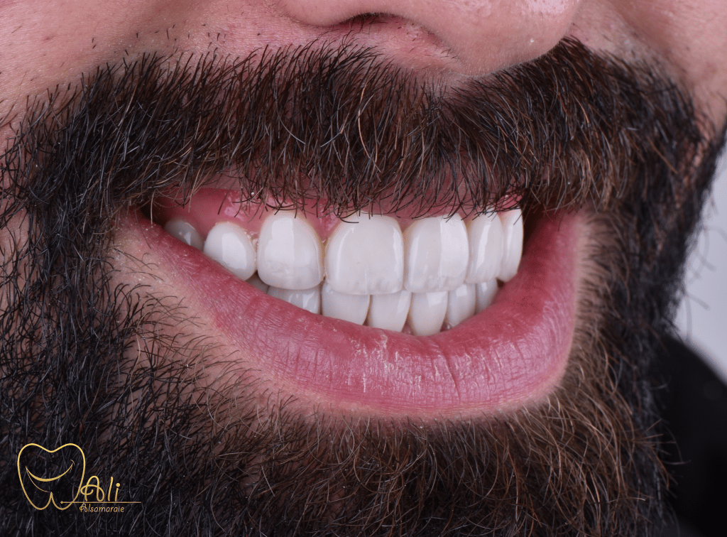 9CC76324-38AB-4CEB-80F6-A95AB1C18AF5