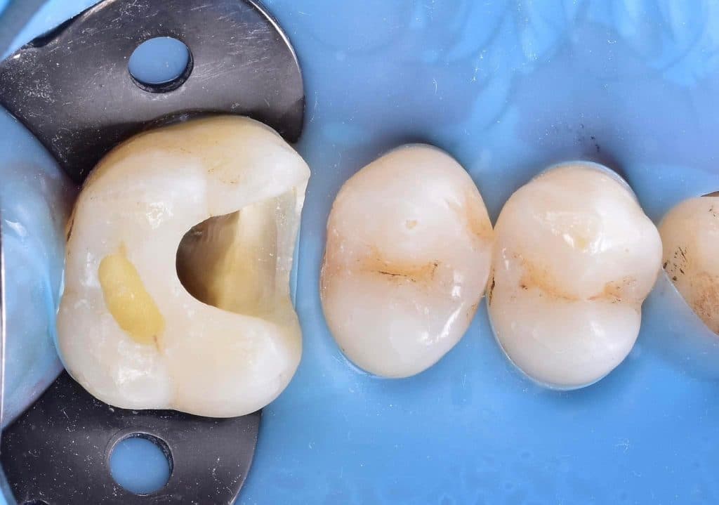 AE76724A-6A0E-4A56-B716-B49325C16487