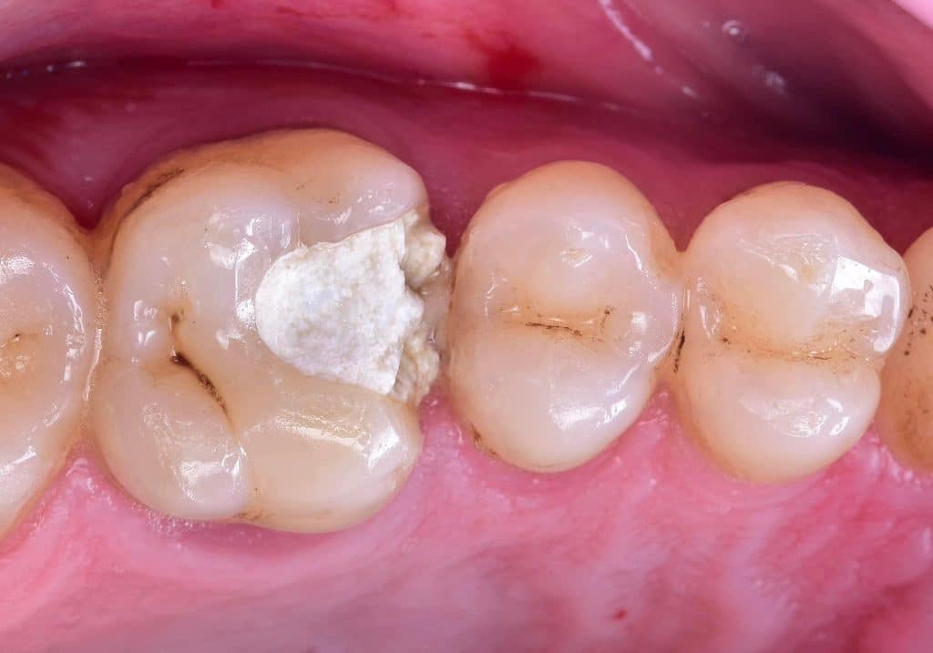 D1D17177-29BD-46C3-A190-7B0D5BB63F52