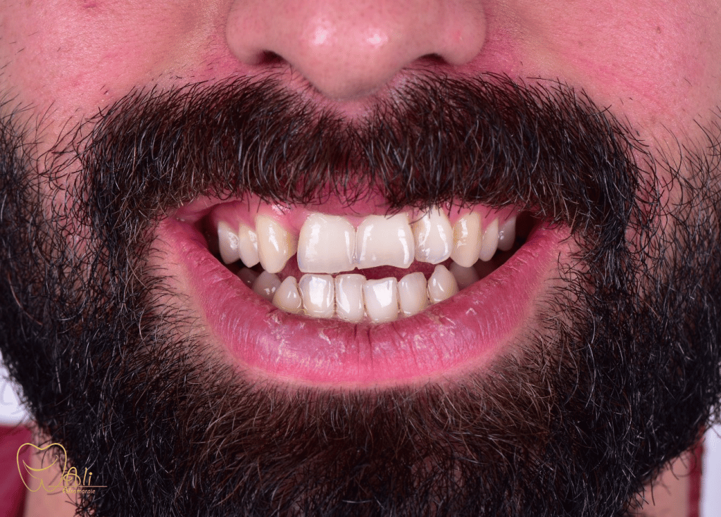 E66FE4ED-A0E6-4846-AC99-4EDEC12977CC