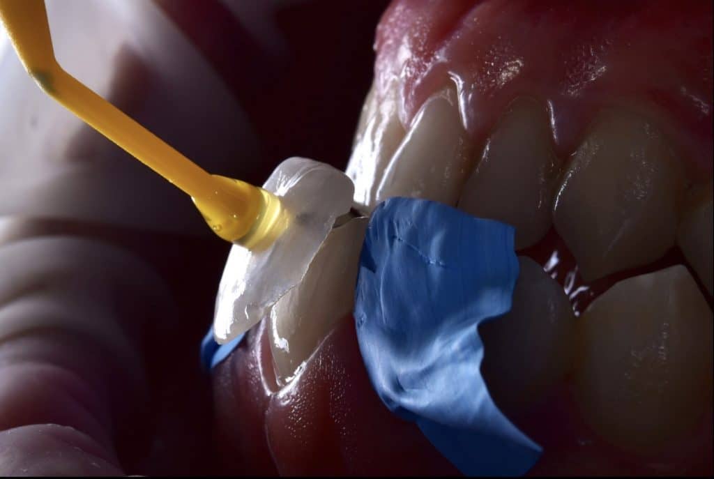 zhouyu_Ding _CASE_02.002