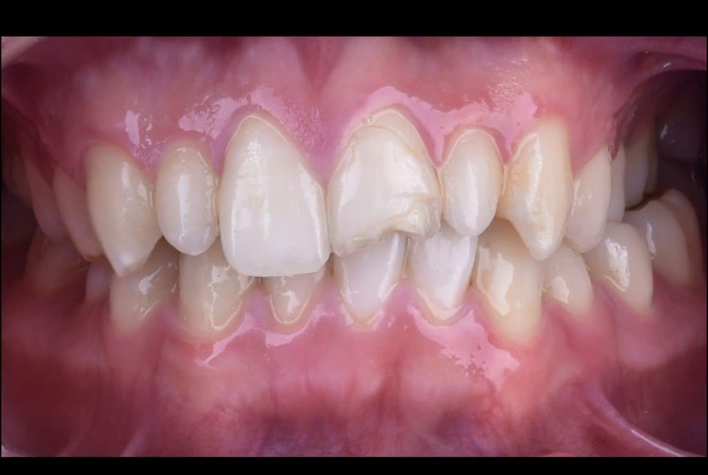 zhouyu_Ding _CASE_02.003