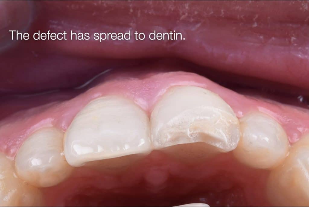 zhouyu_Ding _CASE_02.005