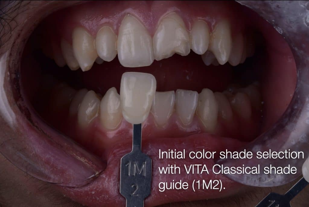 zhouyu_Ding _CASE_02.007