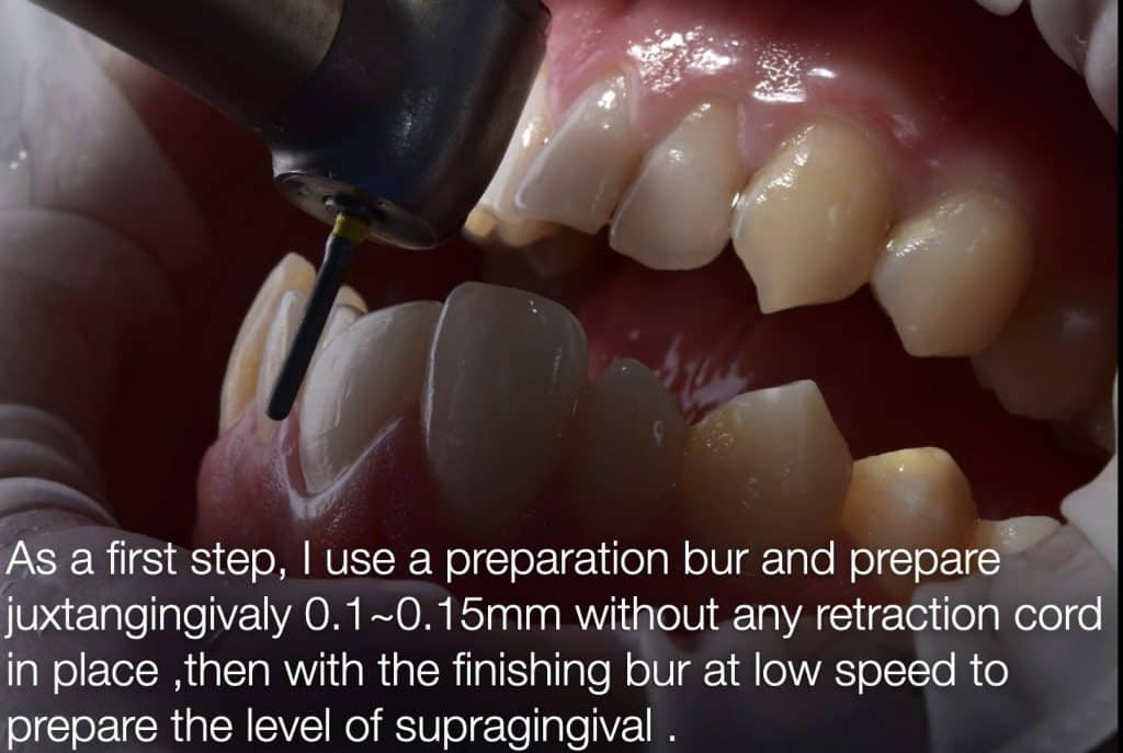 zhouyu_Ding _CASE_02.008