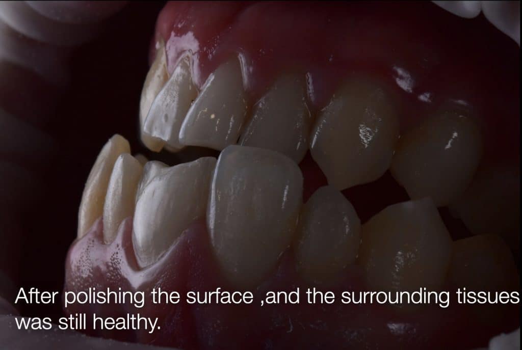 zhouyu_Ding _CASE_02.009