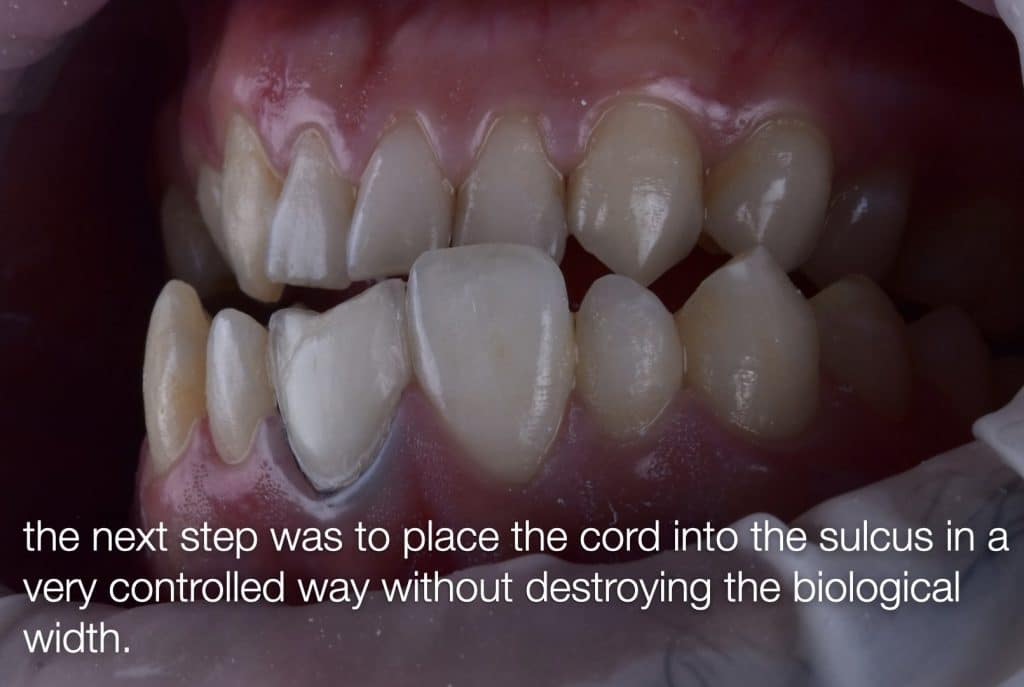 zhouyu_Ding _CASE_02.010