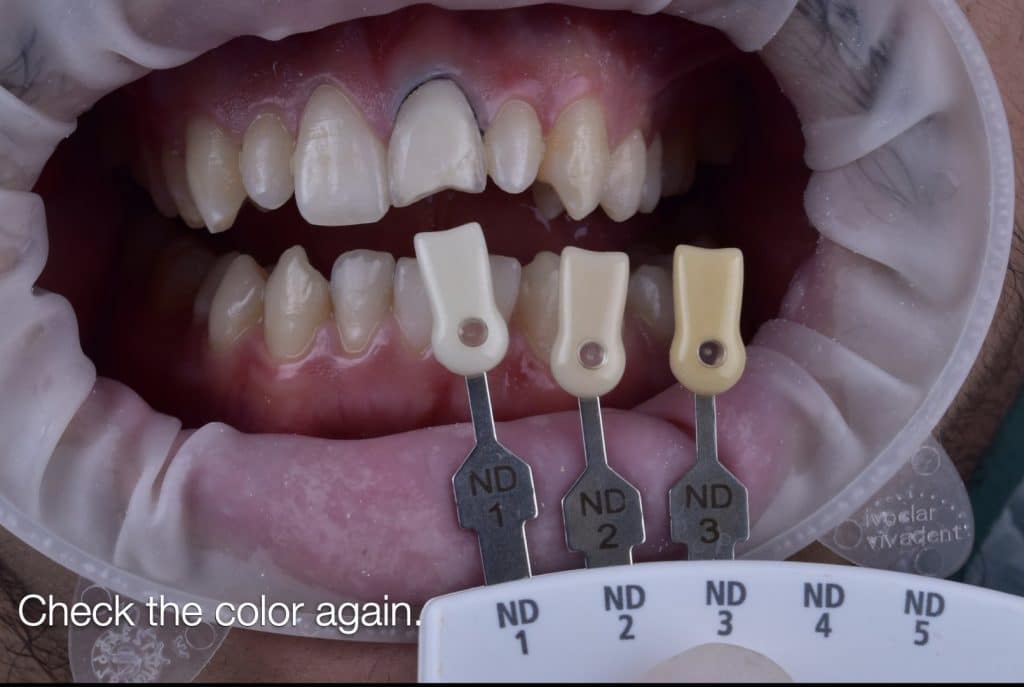 zhouyu_Ding _CASE_02.011