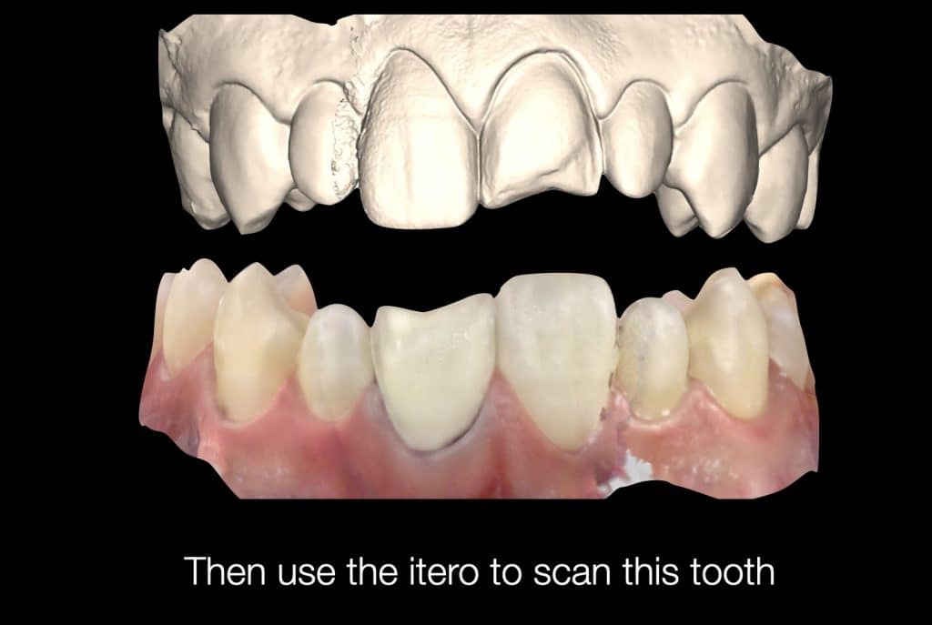 zhouyu_Ding _CASE_02.012