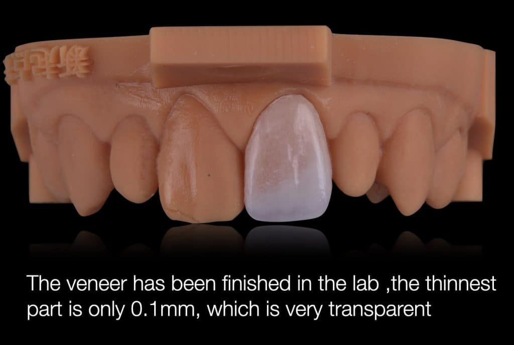 zhouyu_Ding _CASE_02.013