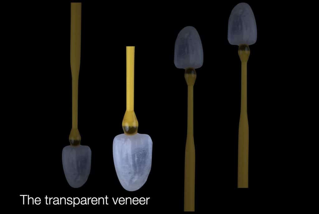 zhouyu_Ding _CASE_02.014