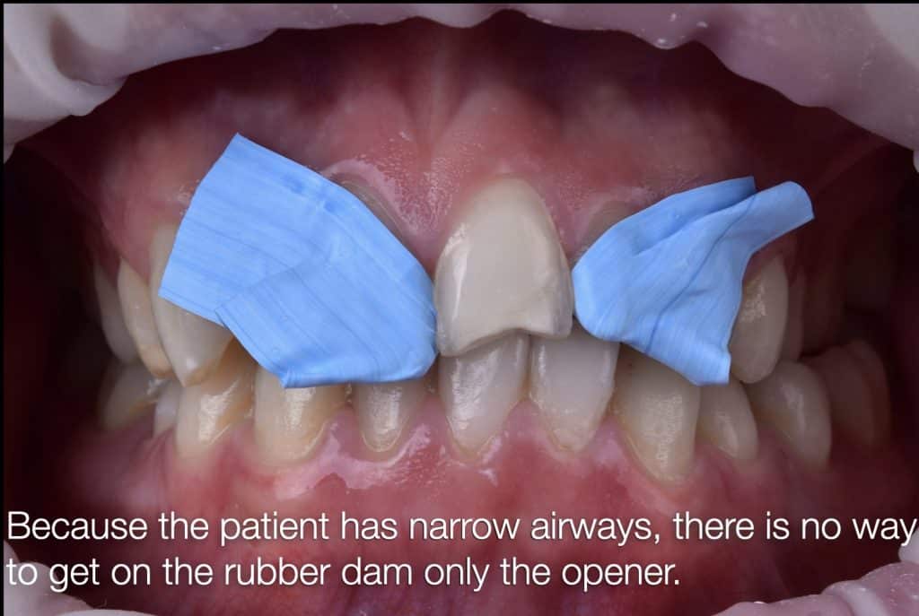 zhouyu_Ding _CASE_02.015