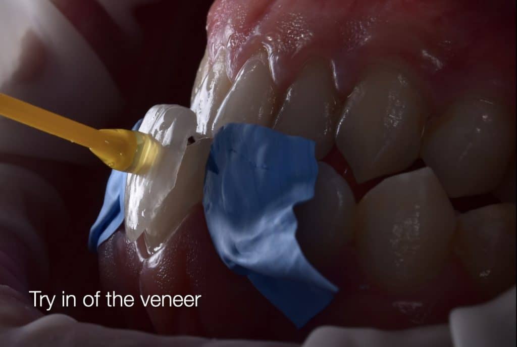 zhouyu_Ding _CASE_02.016