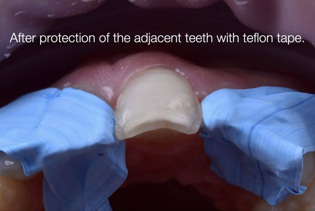 zhouyu_Ding _CASE_02.017