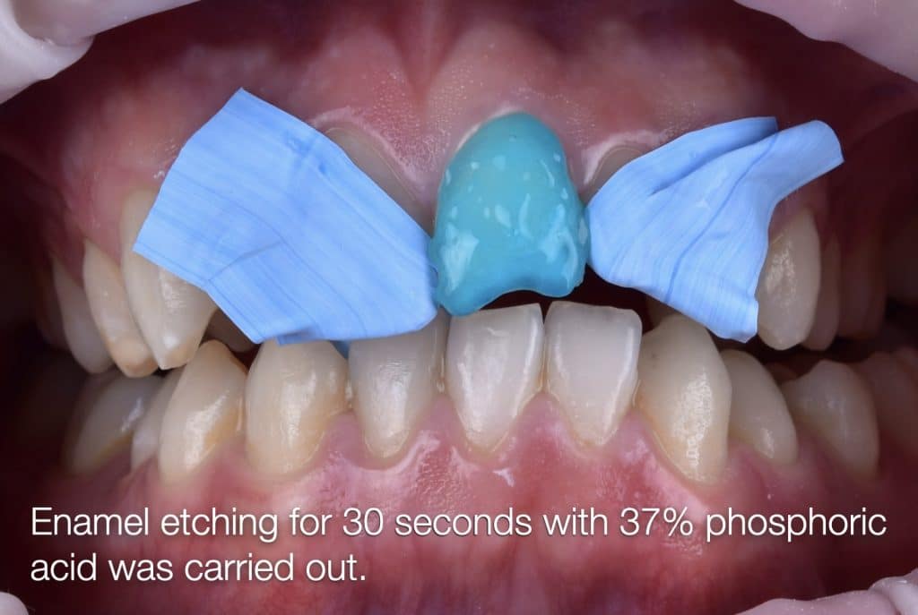 zhouyu_Ding _CASE_02.018