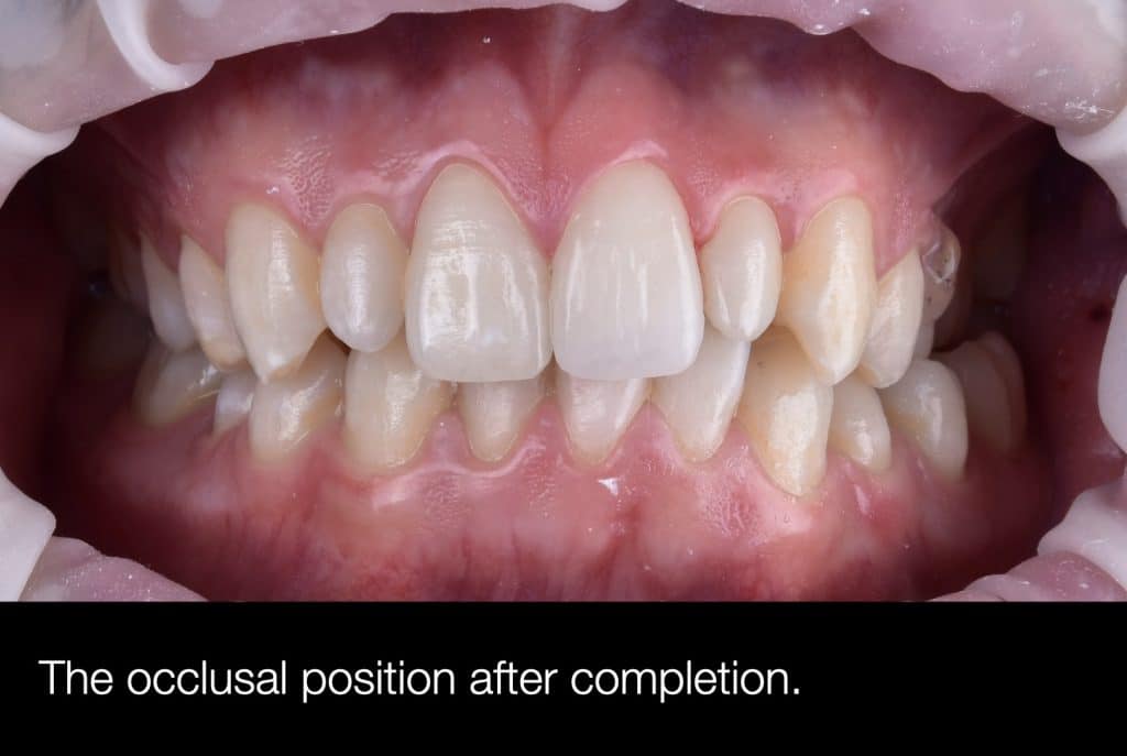 zhouyu_Ding _CASE_02.019