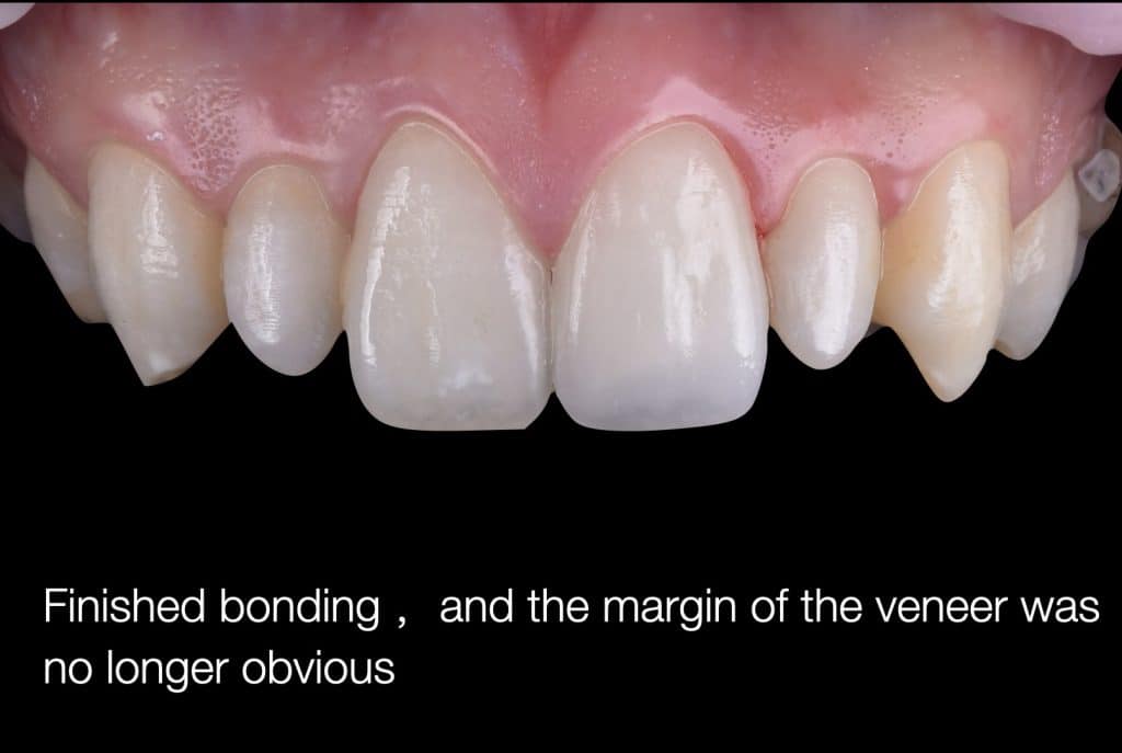 zhouyu_Ding _CASE_02.020